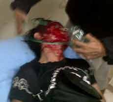 Warga Manukan Jadi Korban Perampasan Sepeda Motor