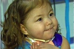 Lahir dengan Hati di Luar Tubuh, Balita Ini Bertahan Setelah 28 Operasi