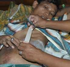 Usus Menyembul Keluar, Iwan Fals Dirawat Ibunya di Rumah