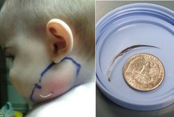 Wah! Ada Bulu Unggas Nongol dari Leher Bayi