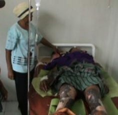 Sumur Minyak Ilegal yang Terbakar di Langkat Berkedalaman 100 Meter