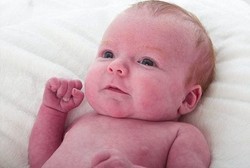 Usai Berfoto Keluarga, Bayi Ini Ketahuan Mengidap Cacat Jantung Langka