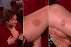 Wow! Pria Ini Punya 5 Puting Susu