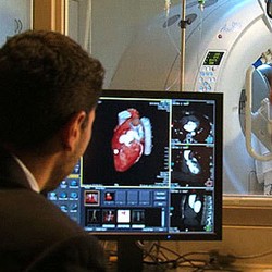 Hebat! Kartu Grafis Dipakai untuk Deteksi Serangan Jantung