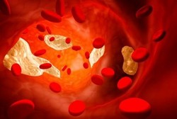 Protein Darah Ini Bisa Indikasikan Depresi Seseorang