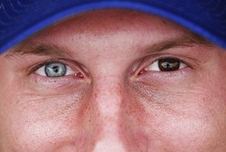 Unik! Orang-orang Ini Terlahir dengan Dua Warna Mata Berbeda