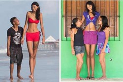 Remaja Tertinggi di Dunia, Baru 17 Tahun Tubuhnya Lebih dari 2 Meter