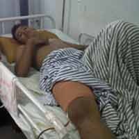 Seorang Remaja di Banyuwangi Mengaku Dipukuli dan Ditembak Polisi