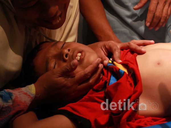 24 Bocah Disunat Massal