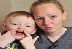 Kehilangan 13 Gigi Susu, Bocah 5 Tahun Ini Dapat Ganti Rugi Rp 141 Juta