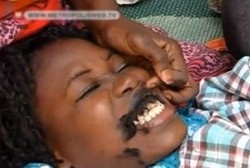 Gusi Gadis Afrika Sengaja Ditato Hitam Legam karena Dianggap Cantik