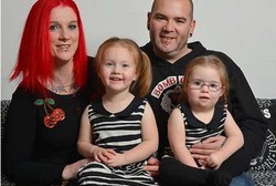 Kembar Tapi Tak Sama, Satu Sehat Satu Lagi Down Syndrome