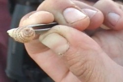 Hiii! Turis Australia Kemasukan Larva Pemakan Daging