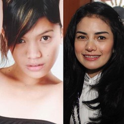 Benarkah 5 Selebriti Indonesia Ini Operasi Plastik?