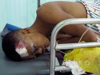 Ledakan Bom Ikan, Curanmor Tewaskan Juru Parkir