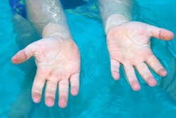 Mengapa Jari Tangan dan Kaki Keriput Setelah Lama Kena Air?