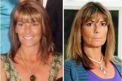 Tubuh Jadi 10 Tahun Lebih Tua Gara-gara Operasi Angkat Rahim