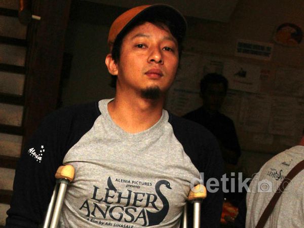 Duh, Kaki Ringgo Agus Rahman Patah