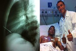 Jantung Tertembak Paku, Untunglah Pemuda Ini Selamat