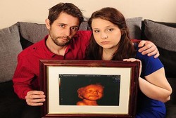 Ibu Ini Tolak Aborsi Meski Mengandung Janin yang Cacat Berat