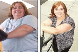 Agar Bebas dari Diabetes, Perempuan Ini Turunkan 62 Kg Bobot Tubuhnya