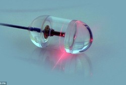 Telanlah Kamera Ini Untuk Deteksi Dini Kanker Kerongkongan