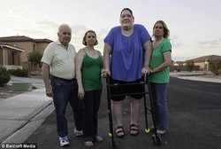 Tumbuh Raksasa, Perempuan Ini Akhirnya Meninggal di Usia 34 Tahun