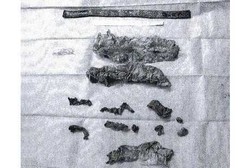 Duh! Dokter Masukkan 16 Benda Asing dalam Tubuh Pasien Saat Operasi