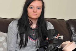 Kasihan, Bahu Perempuan Ini Selalu Terkilir Setiap Kali Bersin