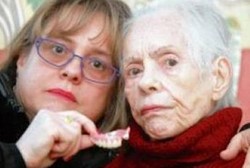 Duh! Gigi Palsu Nyangkut di Kerongkongan, 9 Pekan Tak Ketahuan