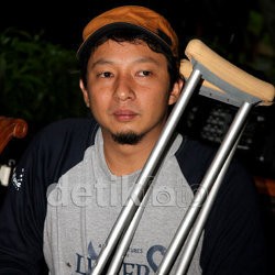 Kecelakaan Syuting, Kaki Ringgo Agus Patah