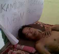 Hudri, Pria Lumpuh di Pasuruan Dijamin Pemerintah Bisa Berobat Gratis