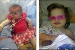 Melepuh 86% Saat Jatuh ke Air Panas, Sekarang Bocah Ini Kembali Cantik