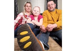 40 Tahun Idap Penyakit Langka, Ayah Ini Baru Ketahuan Setelah Dokter Melihatnya Memasang Tali Sepatu