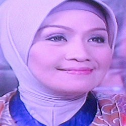 Ditabrak Bintang Tukang Bubur Naik Haji, Bocah 8 Tahun Patah Tulang Rahang