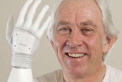 Ini Dia Manusia Pertama di Inggris dengan Tubuh Bionik