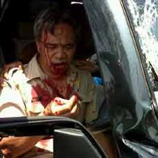 Mobdin Pemkab Situbondo Diseruduk Truk, 4 Penumpang Luka Parah