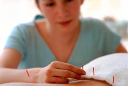 Auriculotherapy, Akupunktur Gaya Baru untuk Wanita yang Ingin Hamil