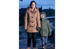 Kena Sindrom Langka, Bocah Ini Tak Boleh Main Salju karena Bisa Meninggal