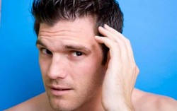 Teh Hijau Cegah Rambut Rontok pada Pria