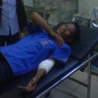 Bacok Lengan Korban, Rp 50 juta dan Emas 3 Ons Berhasil Dibawa Perampok