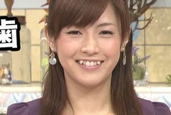 Di Jepang, Gigi yang Cantik adalah yang Mirip Vampir