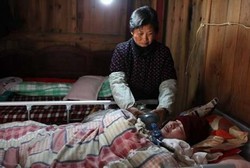 Tak Mampu Bayar Ventilator, Paru-paru Pemuda Ini Dipompa Pakai Tangan