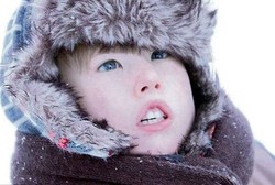 Otot Wajah Lumpuh karena Penyakit Langka, Bocah Ini Tak Bisa Tersenyum