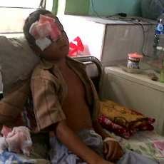 Asyik Main Petak Umpet, Bocah Kelas 4 SD Tertimpa Tembok