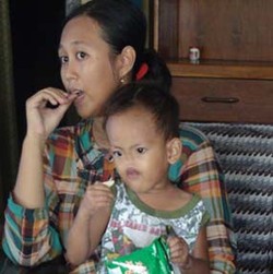 Dava, Bocah Tak Memiliki Hidung Punya Mimpi Jadi Polisi