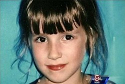 Gadis Ini Dapat Rp 1 Triliun Setelah Kulit Melepuh karena Obat