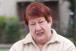 Penyakit Misterius Bikin Wanita Ini Terus Terngiang Suara Musik