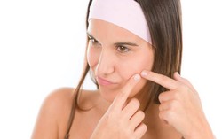 Jerawat Bisa Muncul Gara-gara Makan Udang dan Minum Susu