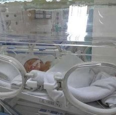 Bantah Tolak Rawat Bayi Dera, 3 RS Mengaku Kekurangan Alat